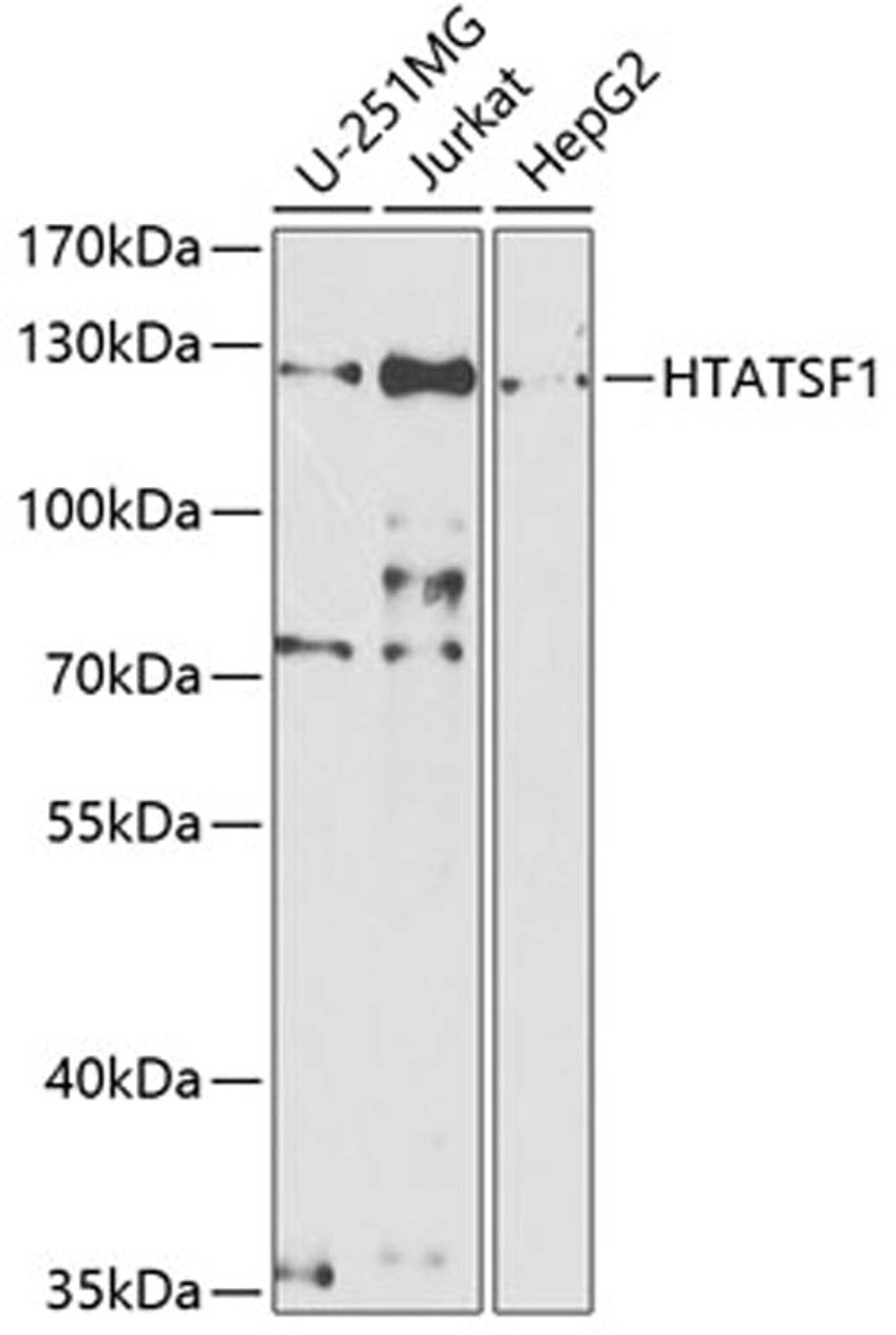 Western blot - HTATSF1 antibody (A5977)