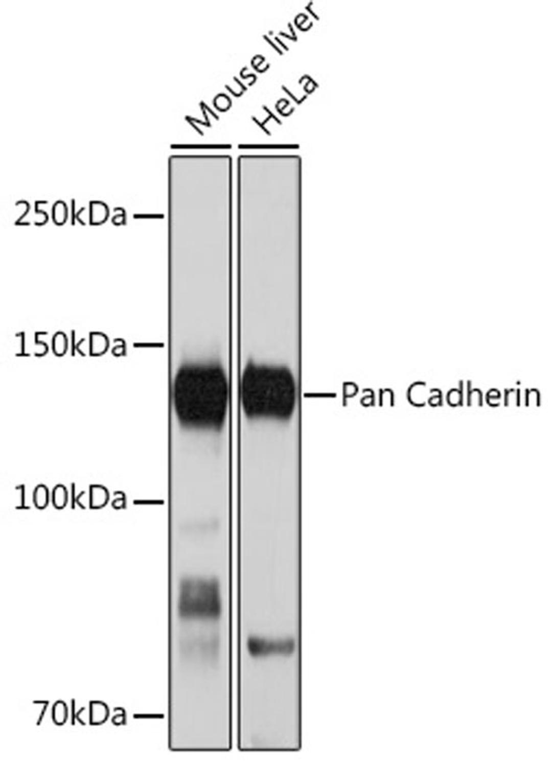 Western blot - Pan Cadherin Rabbit mAb (A4903)