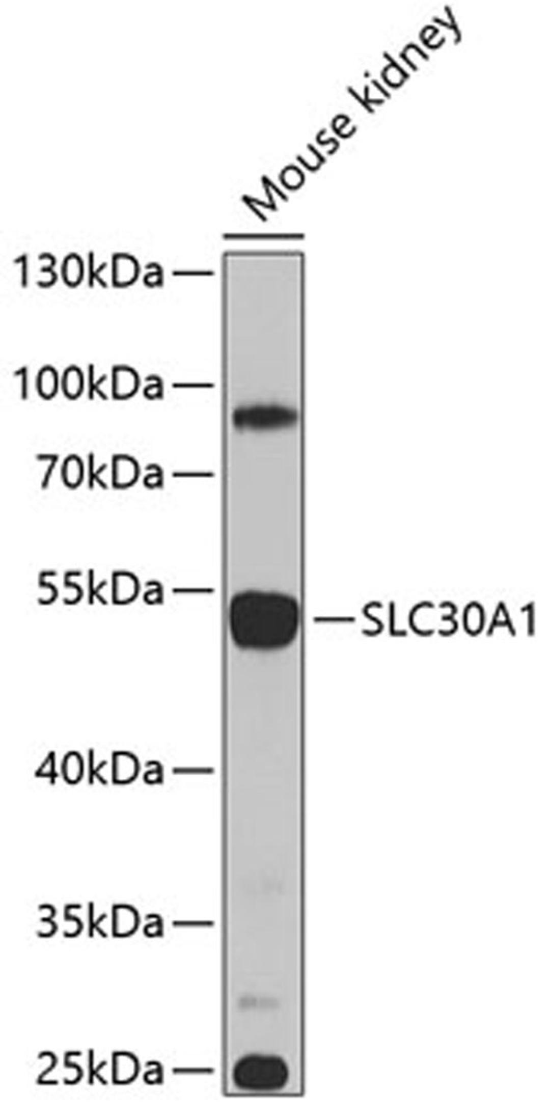 Western blot - SLC30A1 antibody (A9954)