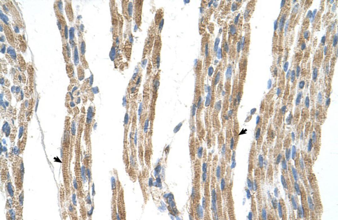 Antibody used in IHC on Human Muscle.