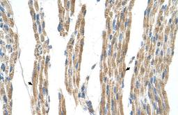 Antibody used in IHC on Human Muscle.