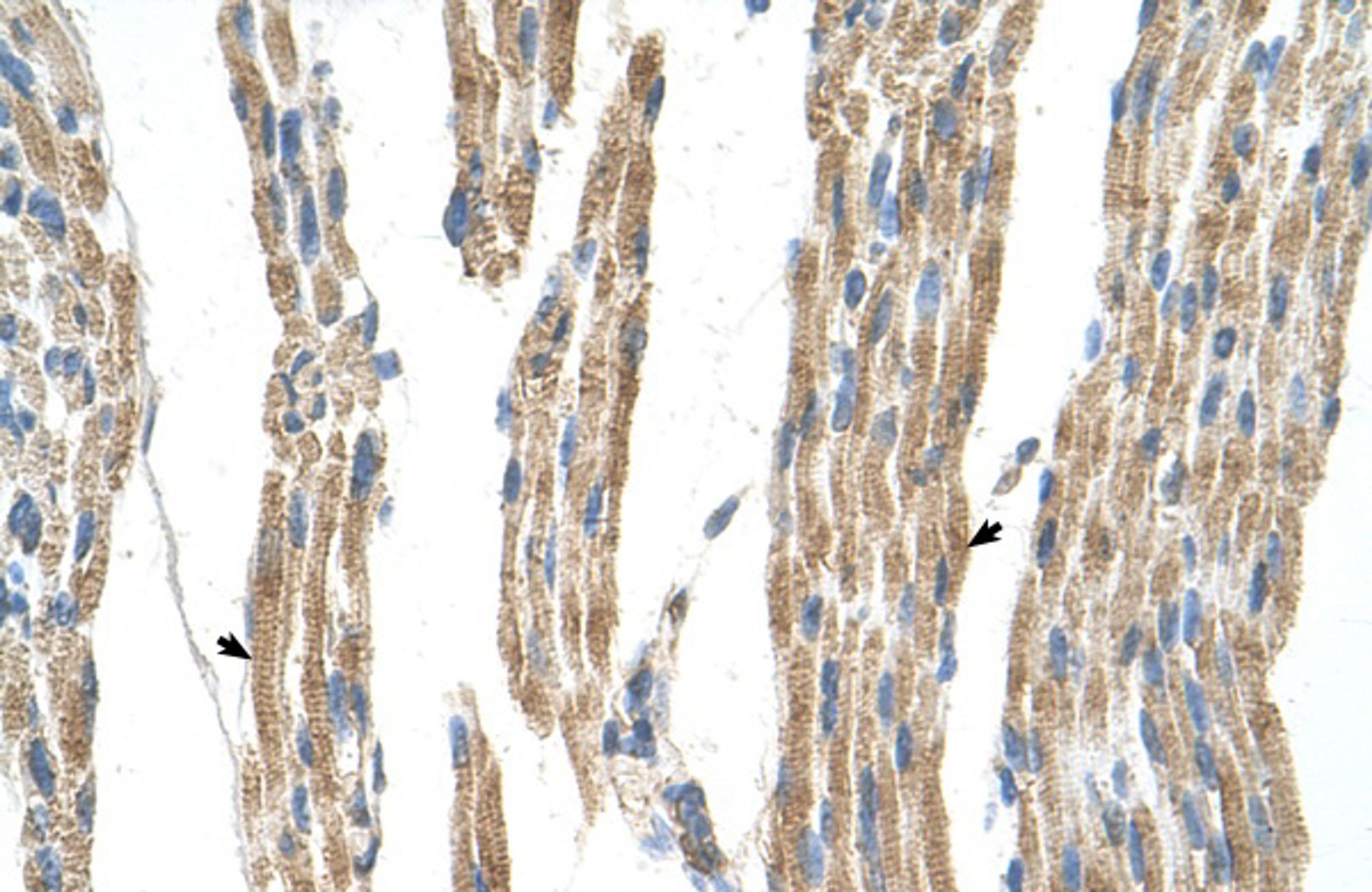 Antibody used in IHC on Human Muscle.