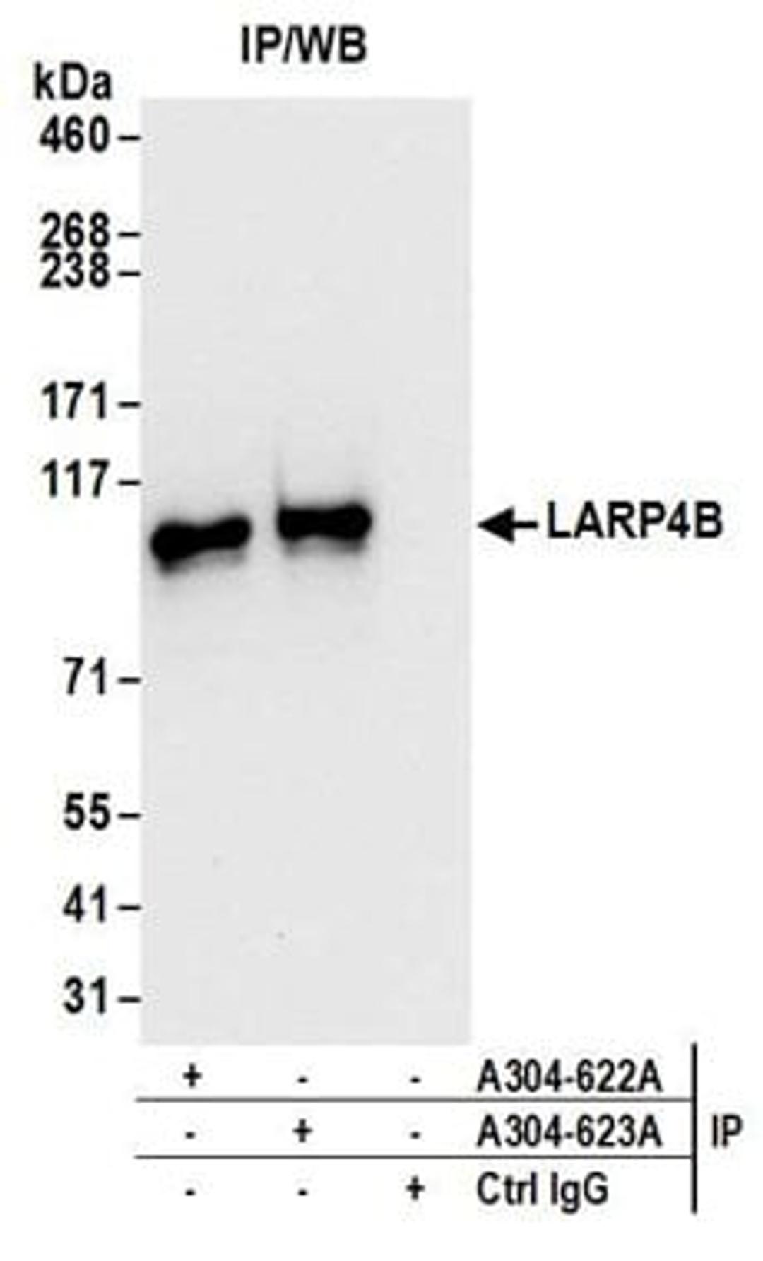 Detection of human LARP4B by western blot of immunoprecipitates.