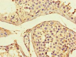 Immunohistochemistry of paraffin-embedded human testis tissue using CSB-PA001376LA01HU at dilution of 1:100