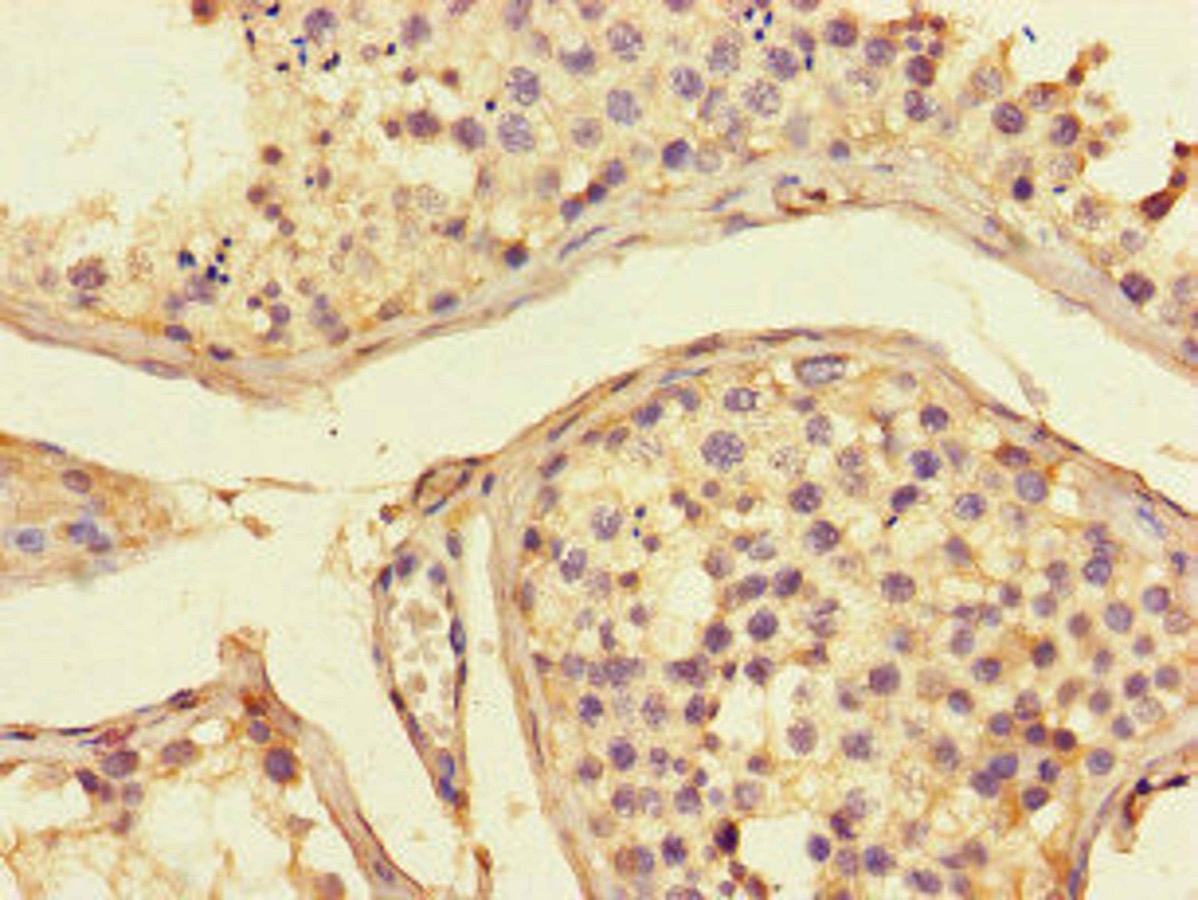 Immunohistochemistry of paraffin-embedded human testis tissue using CSB-PA001376LA01HU at dilution of 1:100
