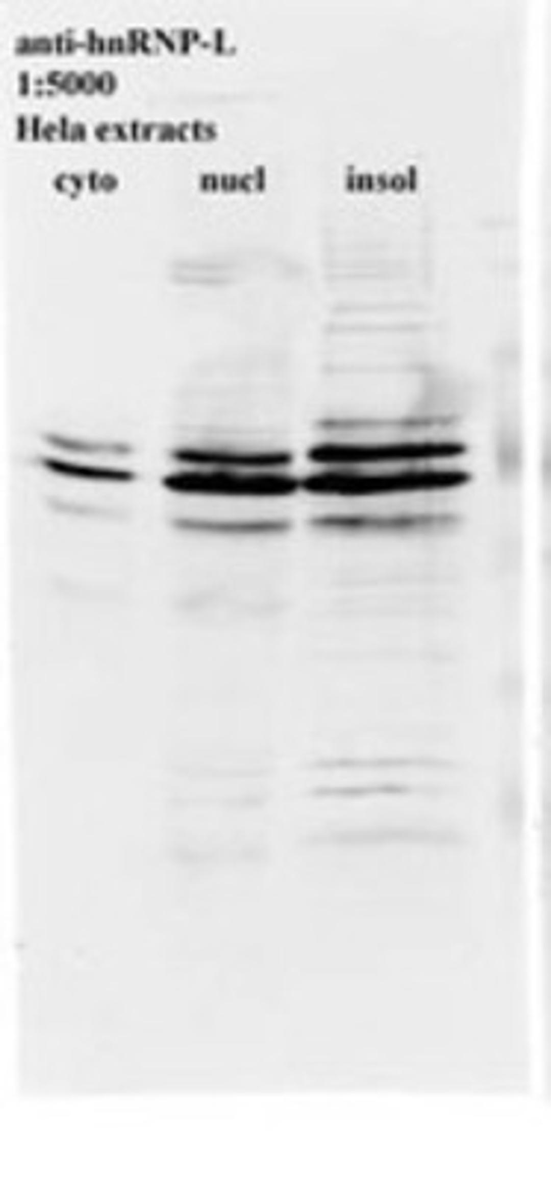 Western Blot: hnRNP L Antibody (4D11) [NB120-6106] - Western blot for anti-hnRNP-L on HeLa cell extracts