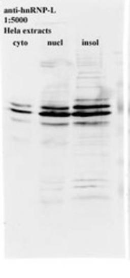 Western Blot: hnRNP L Antibody (4D11) [NB120-6106] - Western blot for anti-hnRNP-L on HeLa cell extracts