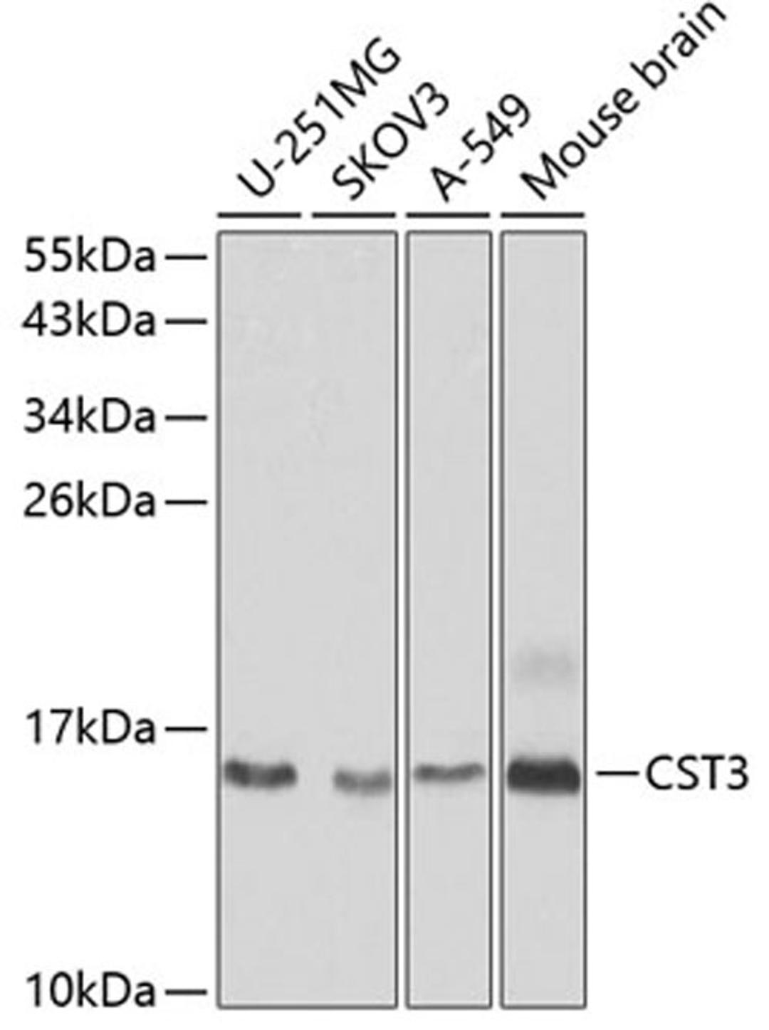 Western blot - CST3 antibody (A13291)