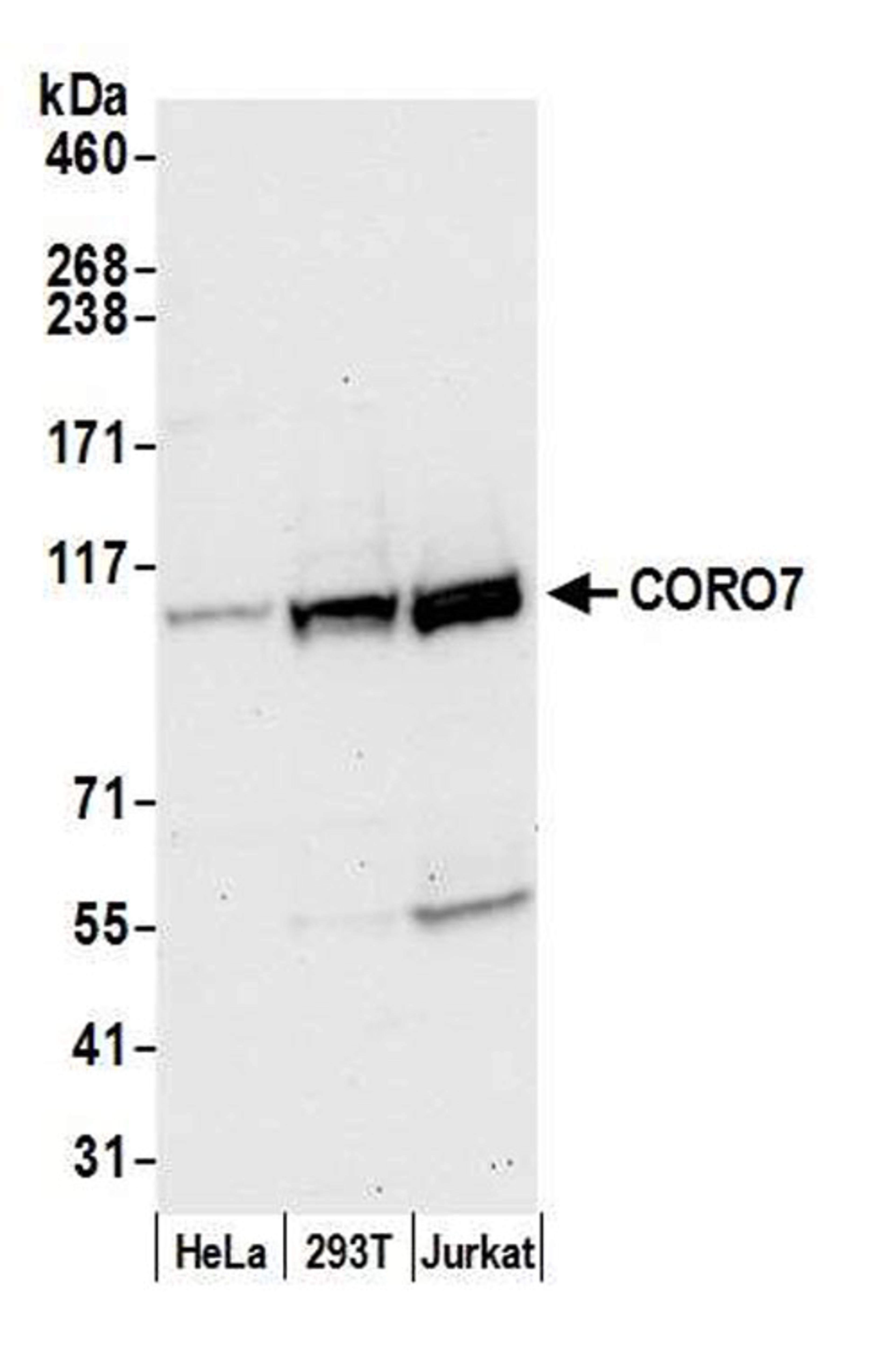 Detection of human CORO7 by WB.