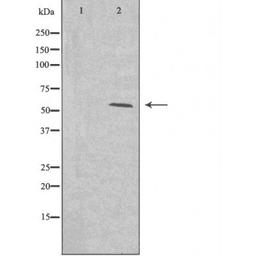 Western blot analysis of HeLa cells 293 cells and A549 cells using 2A13 (Cytochrome P450) antibody