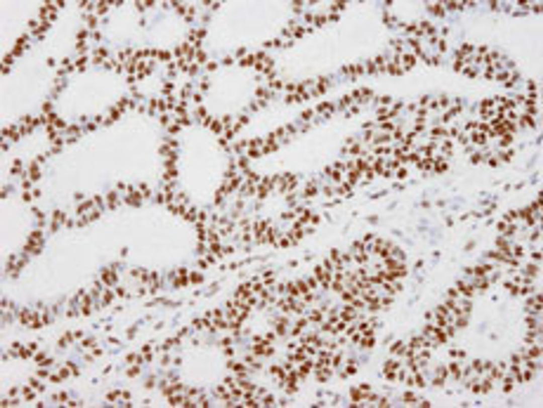 Detection of human KAP-1 by immunohistochemistry.