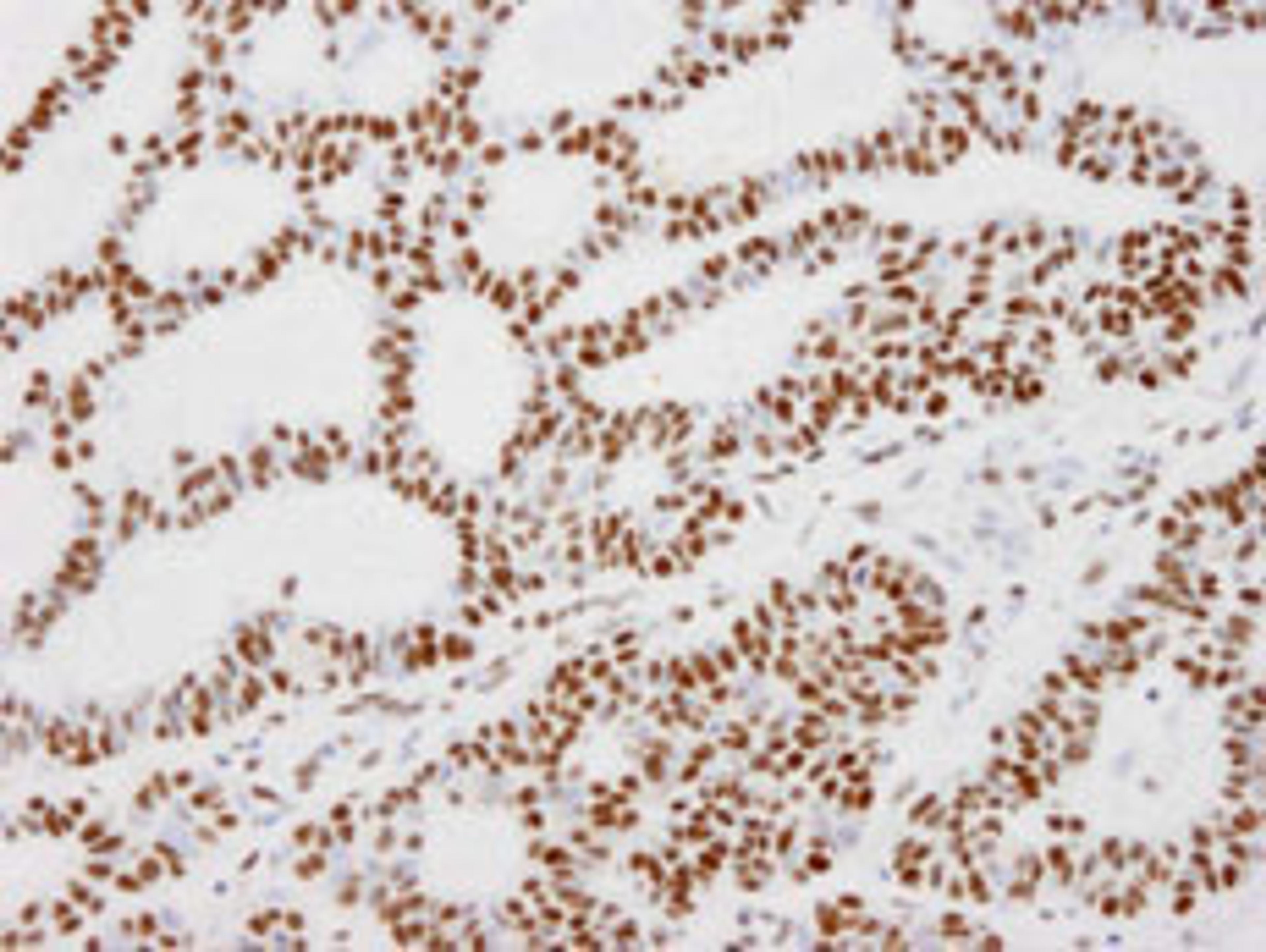 Detection of human KAP-1 by immunohistochemistry.