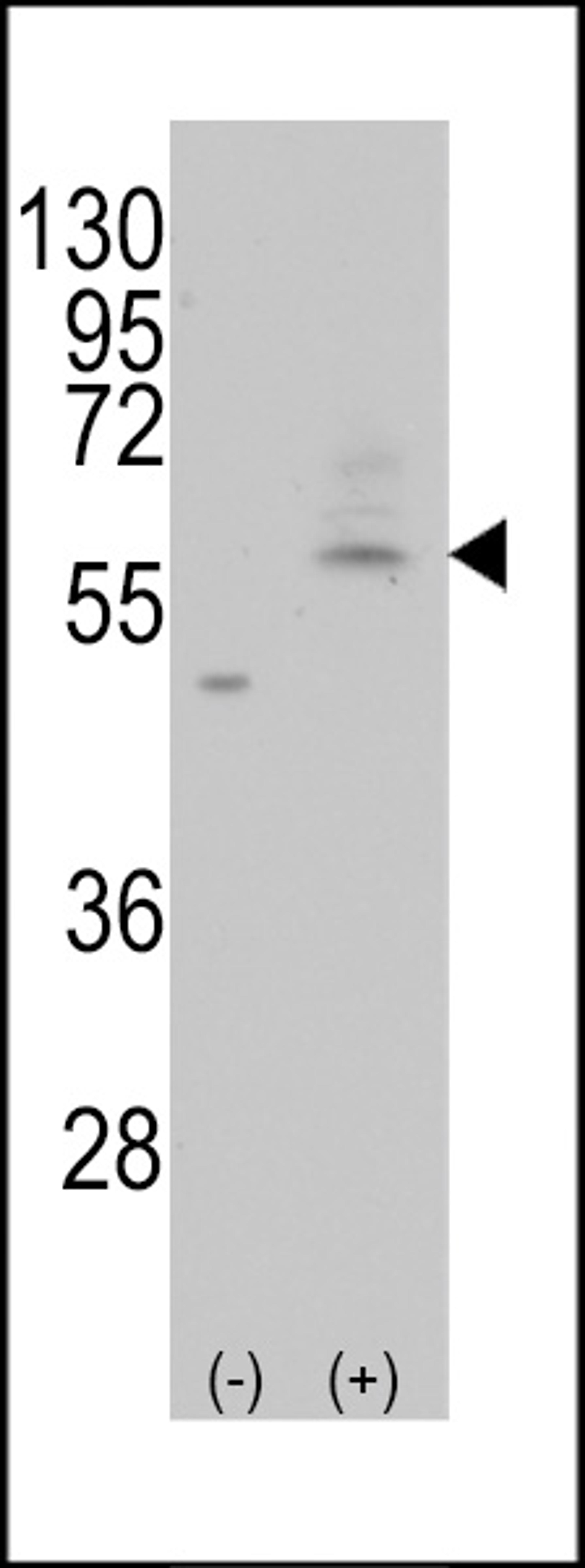 Western blot analysis of PMAT(Slc29a4) using rabbit polyclonal PMAT(Slc29a4) Antibody using 293 cell lysates (2 ug/lane) either nontransfected (Lane 1) or transiently transfected with the PMAT(Slc29a4) gene (Lane 2).