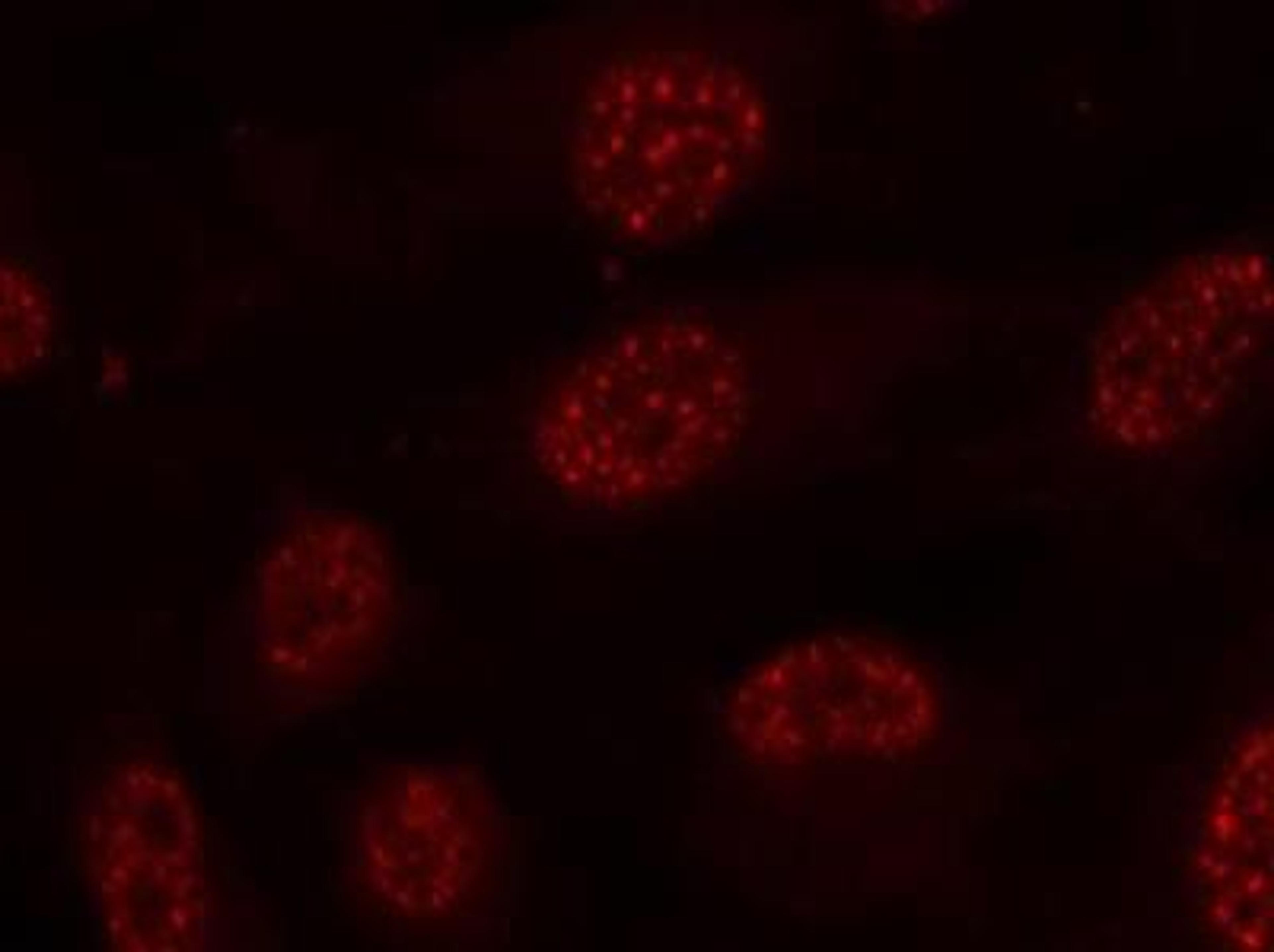 Immunocytochemistry/Immunofluorescence: MAPKAPK2 [p Thr334] Antibody [NB100-82025] - Staining of methanol-fixed Hela cells using MAPKAPK2 [p Thr334] Antibody