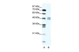 Antibody used in WB on Human Jurkat 5.0 ug/ml.