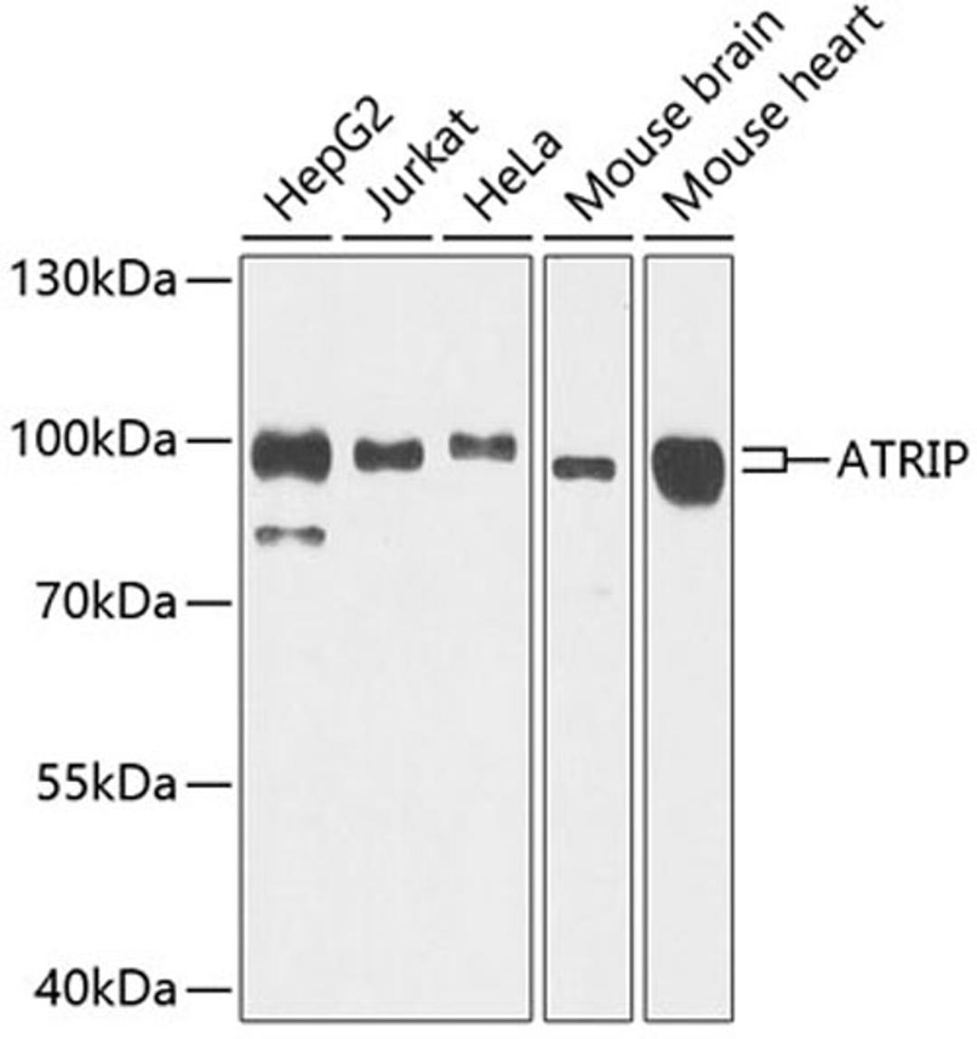 Western blot - ATRIP antibody (A7139)