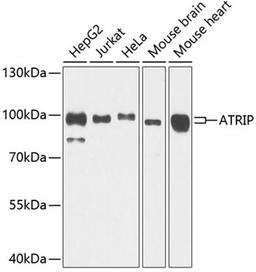 Western blot - ATRIP antibody (A7139)