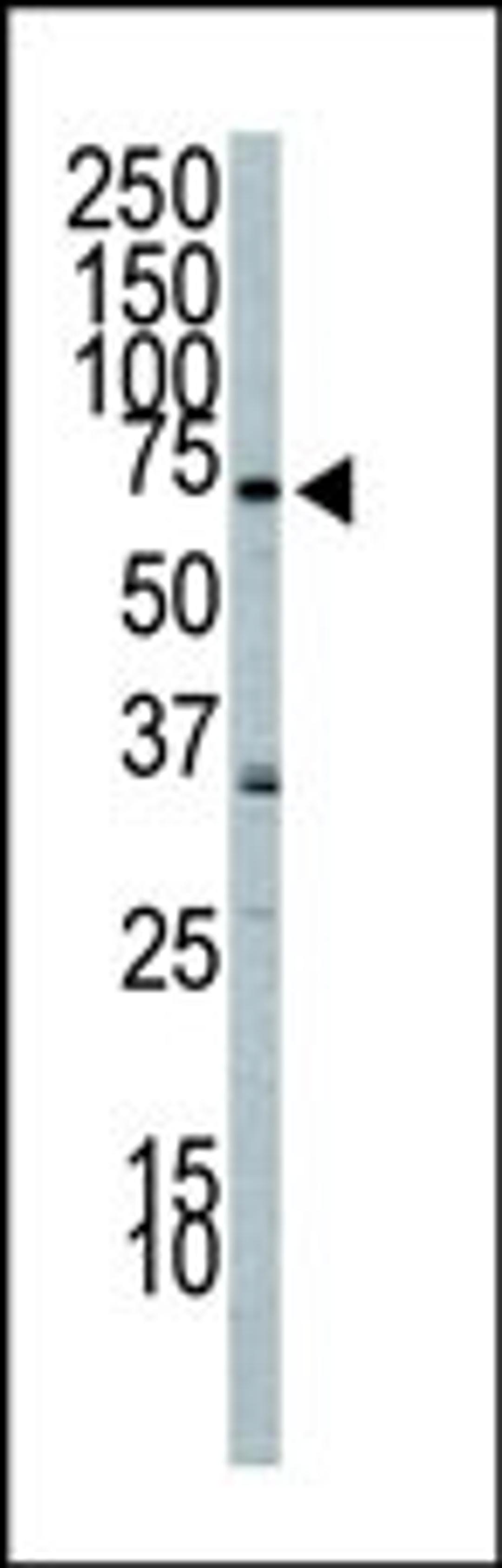 Western Blot in A549 cell lysate. PI3KR2 (arrow) was detected using purified Pab. Secondary HRP-anti-rabbit was used for signal visualization with chemiluminescence.