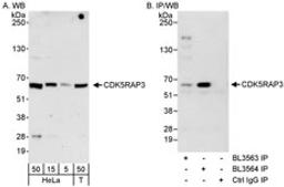 Detection of human CDK5RAP3 by western blot and immunoprecipitation.