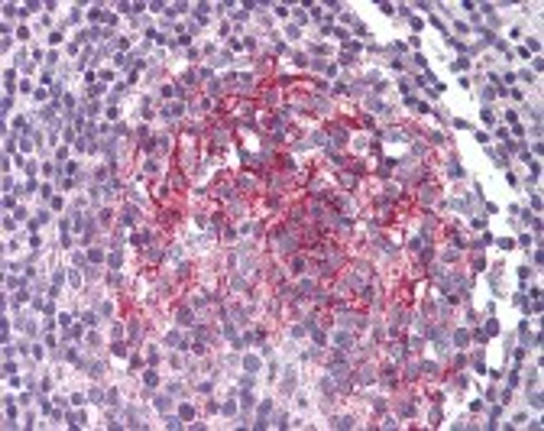 Immunohistochemistry staining of IL-1 receptor type 2 in small intestine, peyer's patch tissue using IL-1 receptor type 2 Antibody.