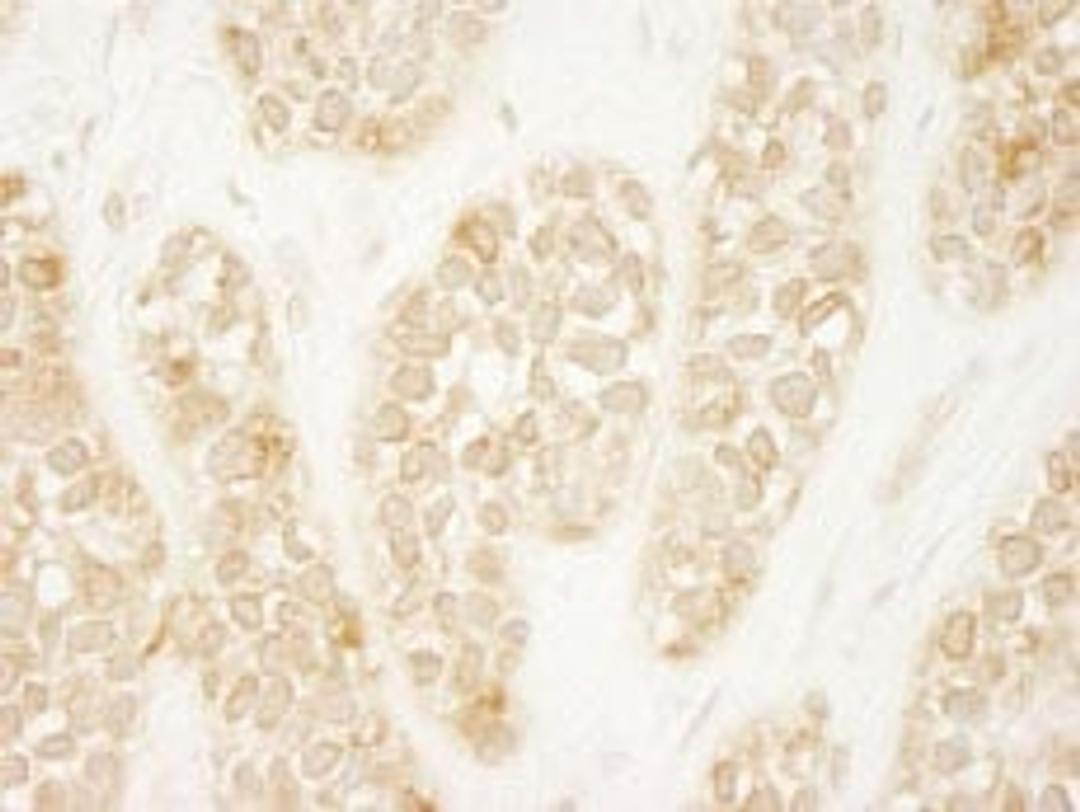 Detection of human ARHGEF16 by immunohistochemistry.