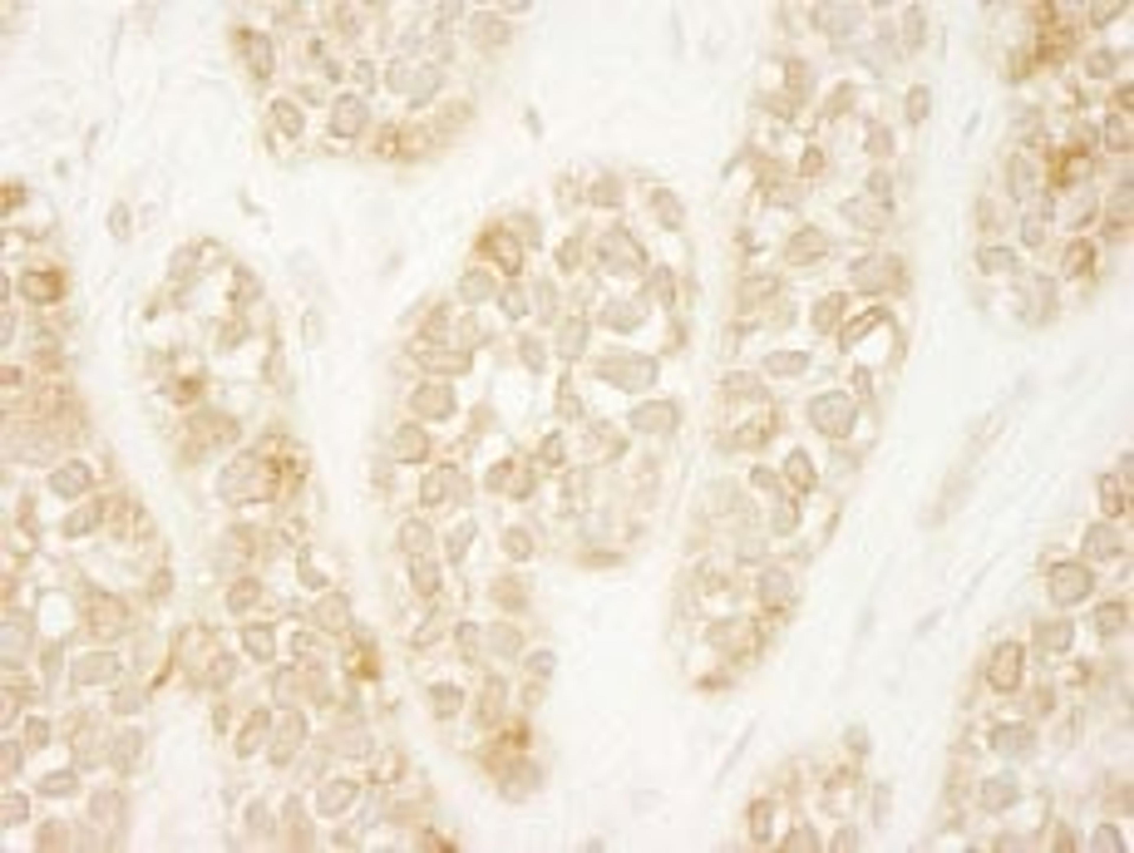 Detection of human ARHGEF16 by immunohistochemistry.