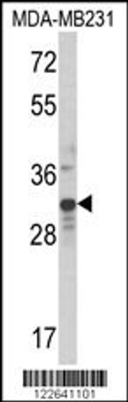 Western blot analysis of MLX Antibody in MDA-MB231 cell line lysates (35ug/lane)