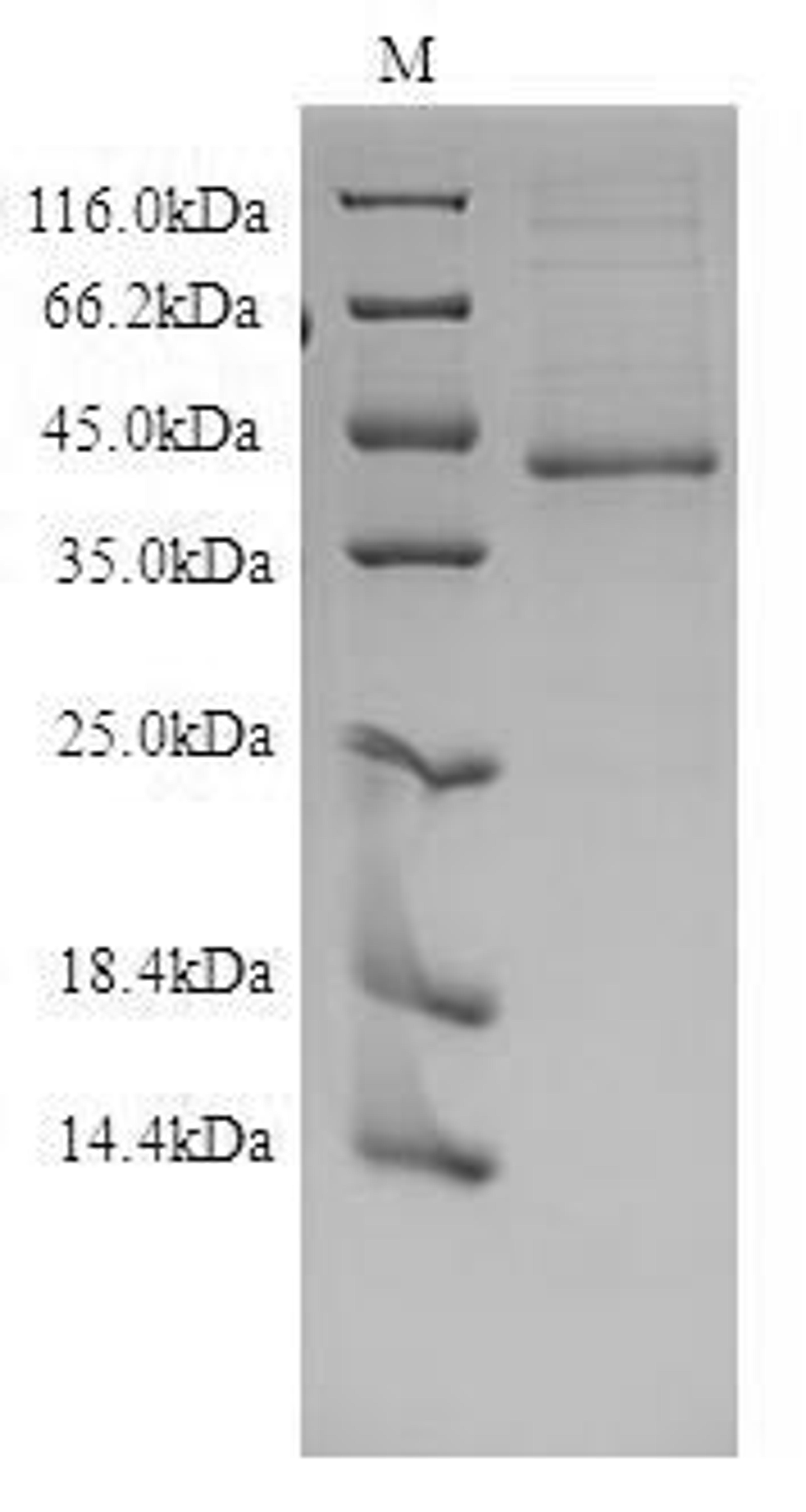 (Tris-Glycine gel) Discontinuous SDS-PAGE (reduced) with 5% enrichment gel and 15% separation gel.