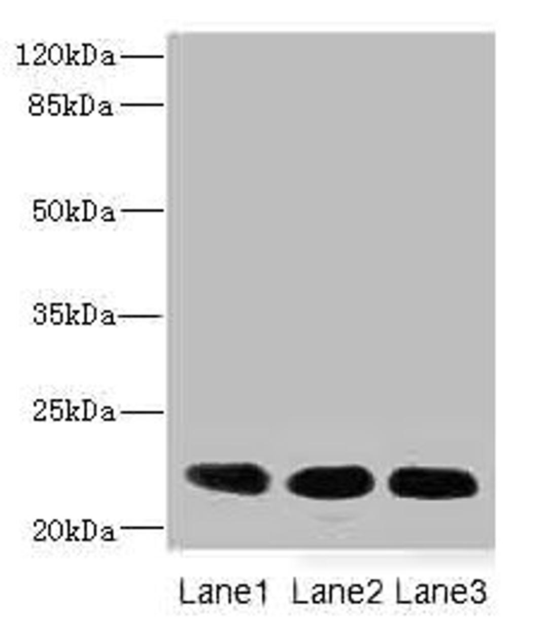 Western blot. All lanes: CRIP2 antibody at 4.68µg/ml. Lane 1: Rat heart tissue. Lane 2: Mouse lung tissue. Lane 3: MCF-7 whole cell lysate. Secondary. Goat polyclonal to rabbit IgG at 1/10000 dilution. Predicted band size: 23, 31 kDa. Observed band size: 23 kDa