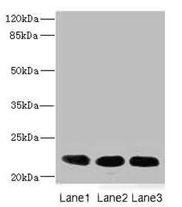 Western blot. All lanes: CRIP2 antibody at 4.68µg/ml. Lane 1: Rat heart tissue. Lane 2: Mouse lung tissue. Lane 3: MCF-7 whole cell lysate. Secondary. Goat polyclonal to rabbit IgG at 1/10000 dilution. Predicted band size: 23, 31 kDa. Observed band size: 23 kDa