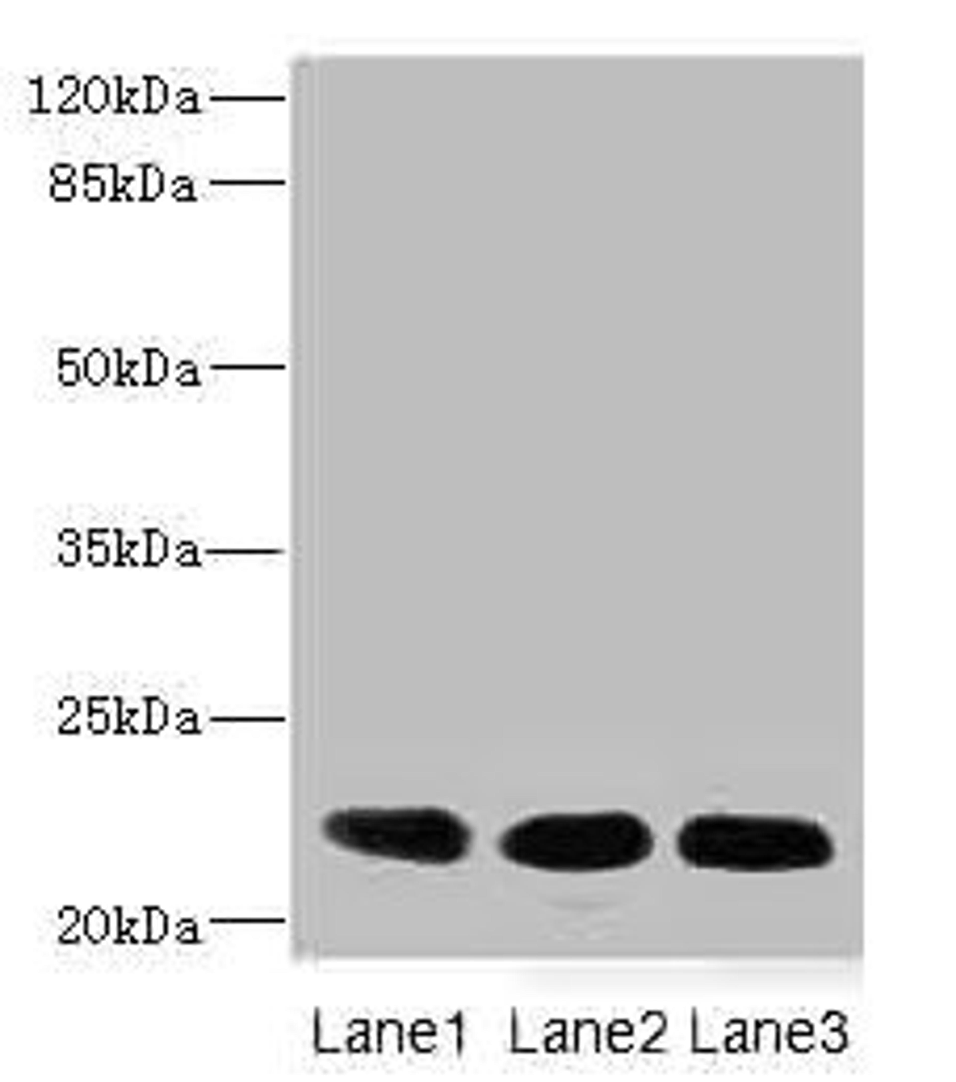 Western blot. All lanes: CRIP2 antibody at 4.68µg/ml. Lane 1: Rat heart tissue. Lane 2: Mouse lung tissue. Lane 3: MCF-7 whole cell lysate. Secondary. Goat polyclonal to rabbit IgG at 1/10000 dilution. Predicted band size: 23, 31 kDa. Observed band size: 23 kDa