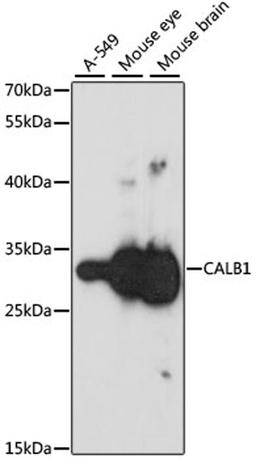 Western blot - CALB1 antibody (A0802)