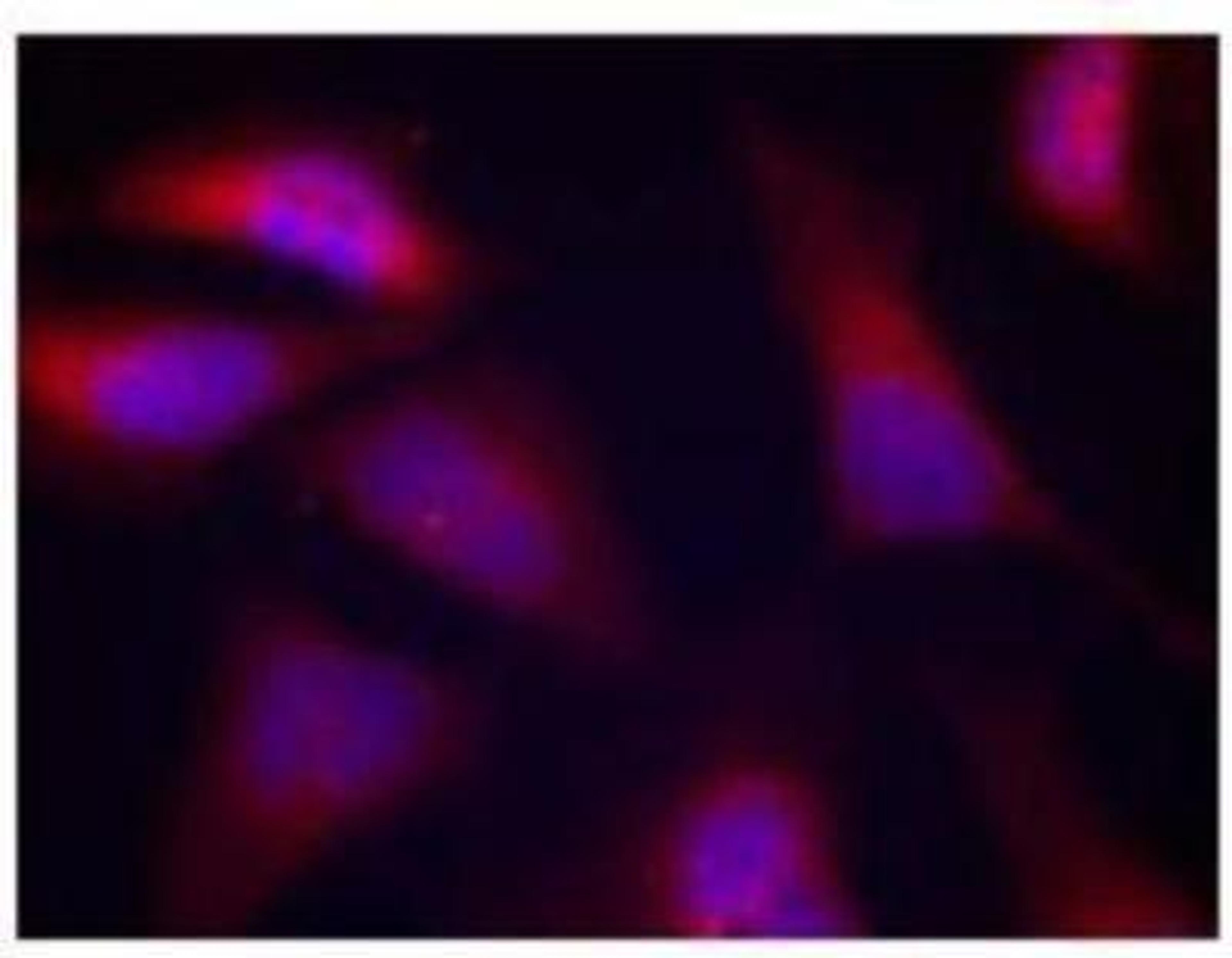 Immunocytochemistry/Immunofluorescence: PKR [p Thr446] Antibody [NB100-82156] - Immunofluorescent staining of methanol-fixed Hela cells using PKR [p Thr446] antibody.