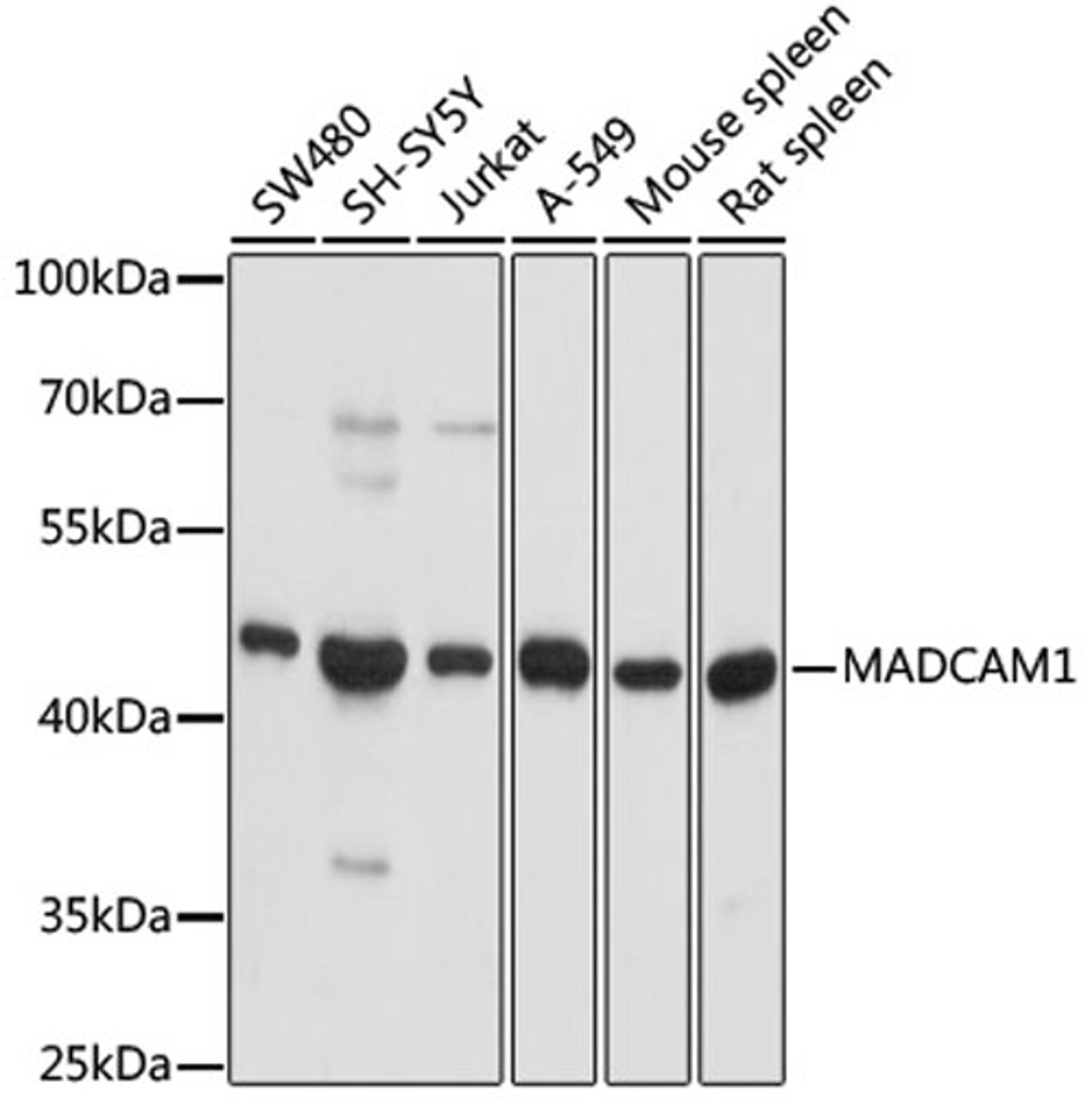 Western blot - MADCAM1 antibody (A3005)