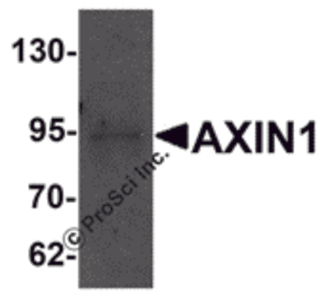 Western blot analysis of AXIN1 in SK-N-SH cell lysate with AXIN1 antibody at 1 &#956;g/mL.