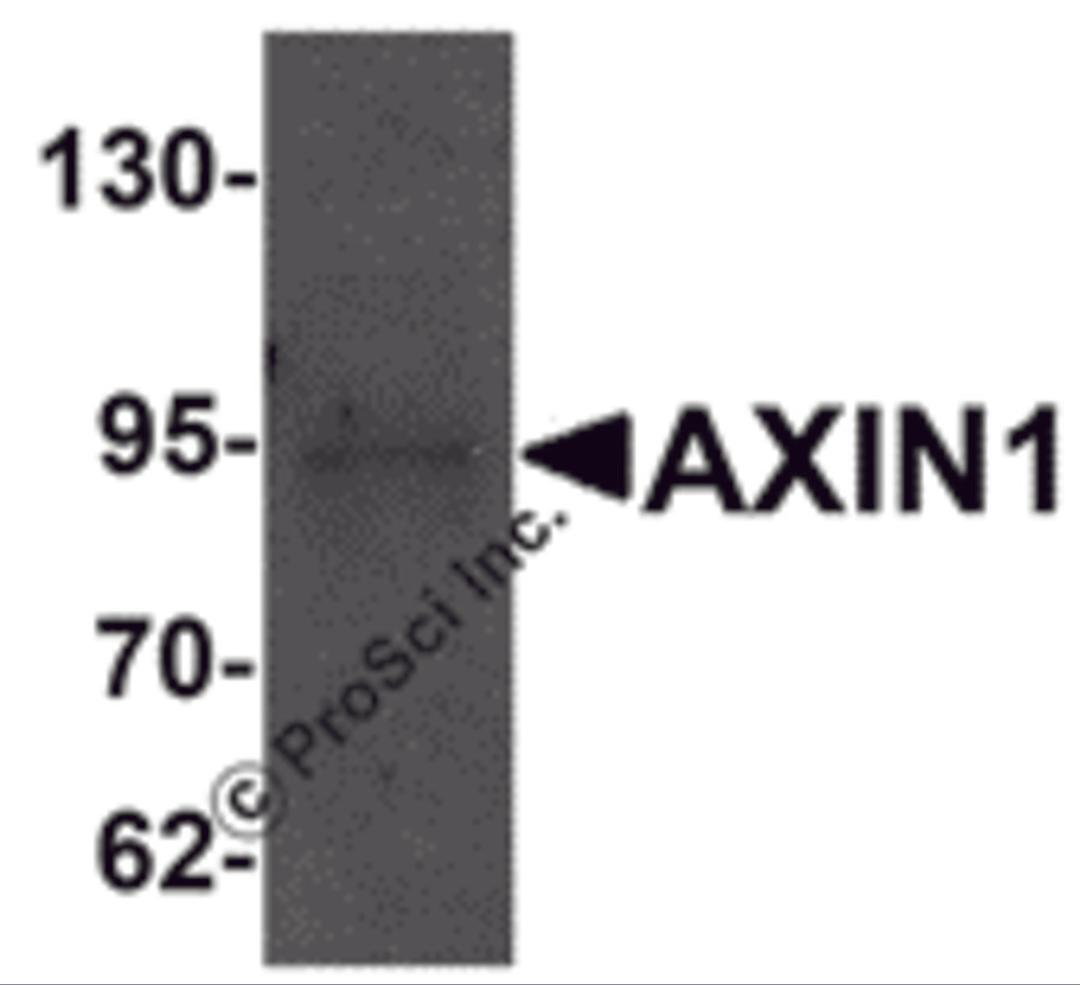 Western blot analysis of AXIN1 in SK-N-SH cell lysate with AXIN1 antibody at 1 μg/mL.