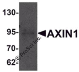 Western blot analysis of AXIN1 in SK-N-SH cell lysate with AXIN1 antibody at 1 μg/mL.
