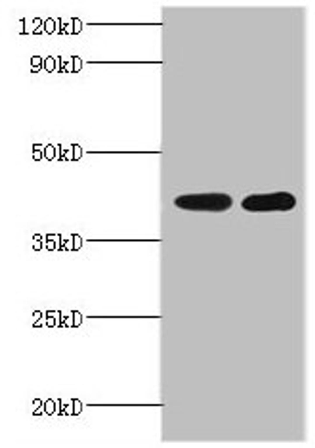 Western blot. All lanes: GLT8D2 antibody at 2µg/ml. Lane 1: Mouse heart tissue. Lane 2: Mouse kidney tissue. Secondary. Goat polyclonal to rabbit IgG at 1/10000 dilution. Predicted band size: 41 kDa. Observed band size: 41 kDa