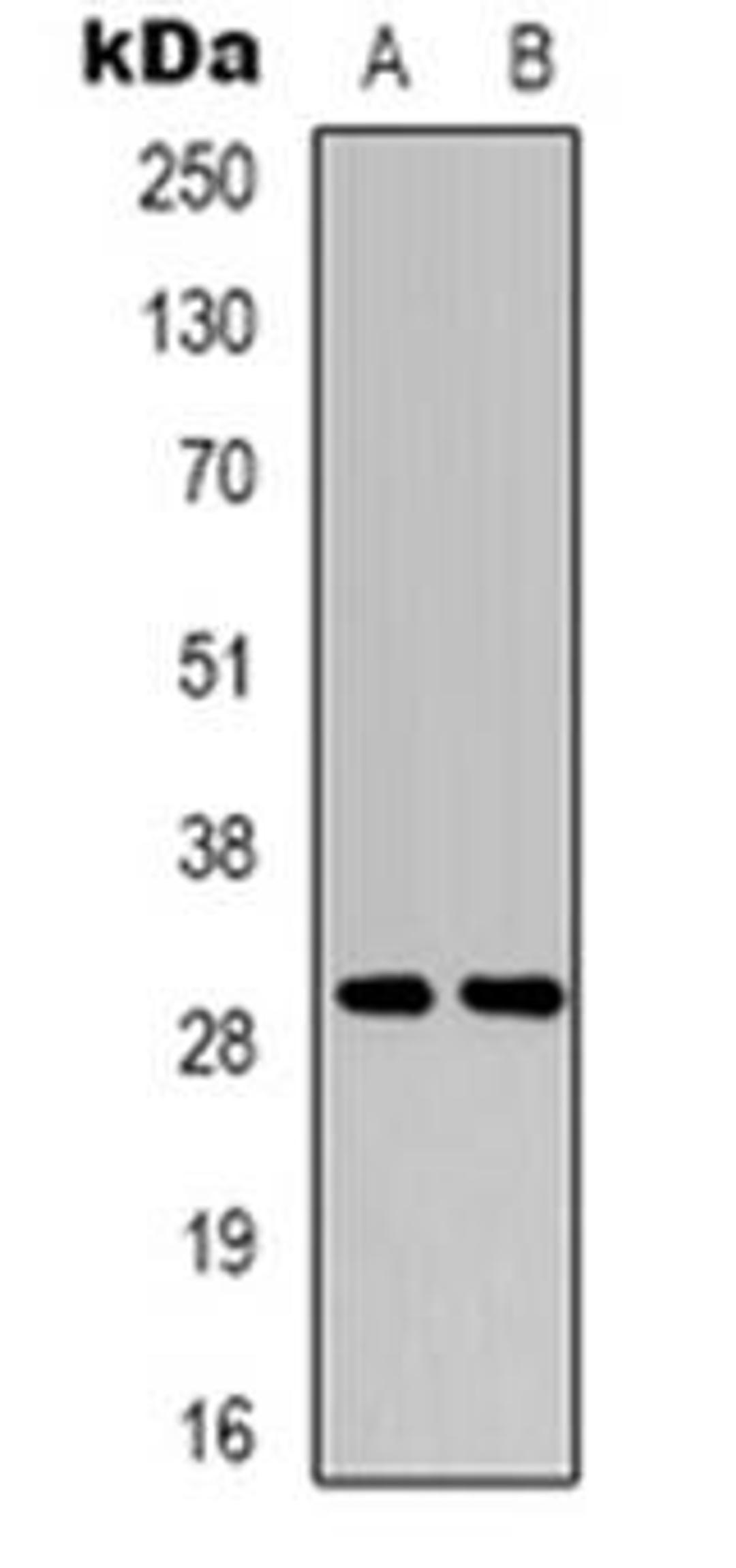 Western blot analysis of RIMS4 expression in Hela (Lane 1), NIH3T3 (Lane 2) whole cell lysates using RIMS4 antibody