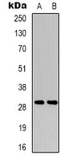 Western blot analysis of RIMS4 expression in Hela (Lane 1), NIH3T3 (Lane 2) whole cell lysates using RIMS4 antibody