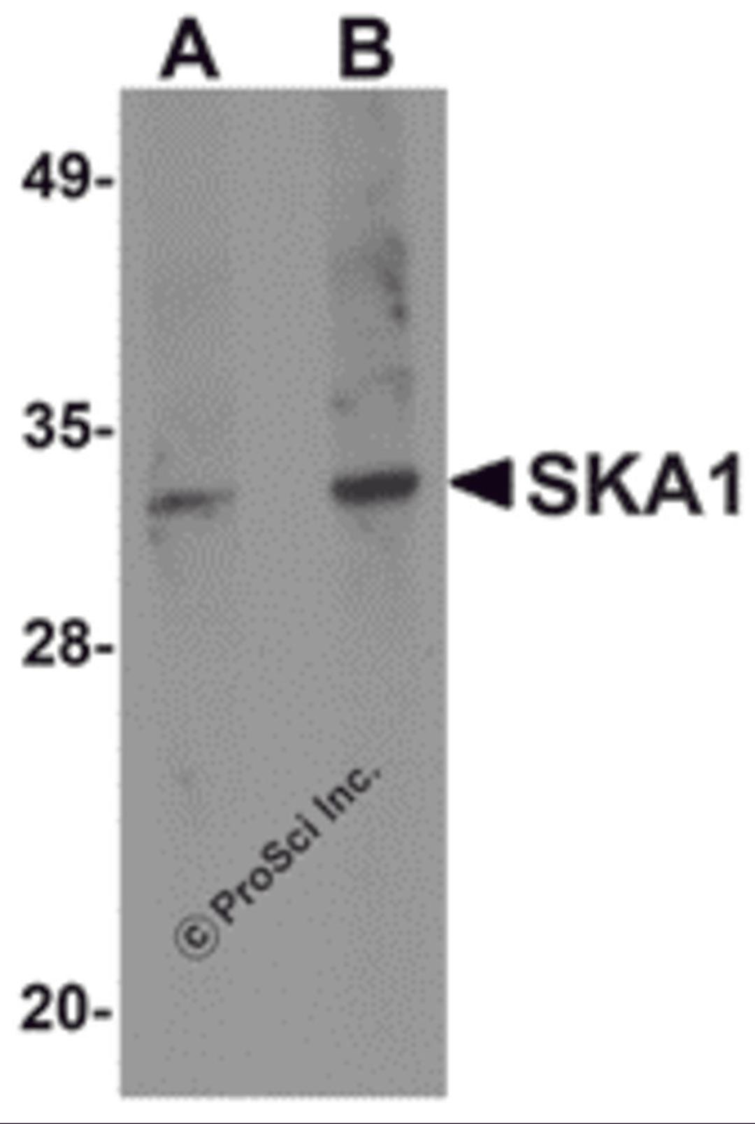 Western blot analysis of SKA1 in A549 cell lysate with SKA1 antibody at (A) 0.5 and (B) 1 μg/mL.