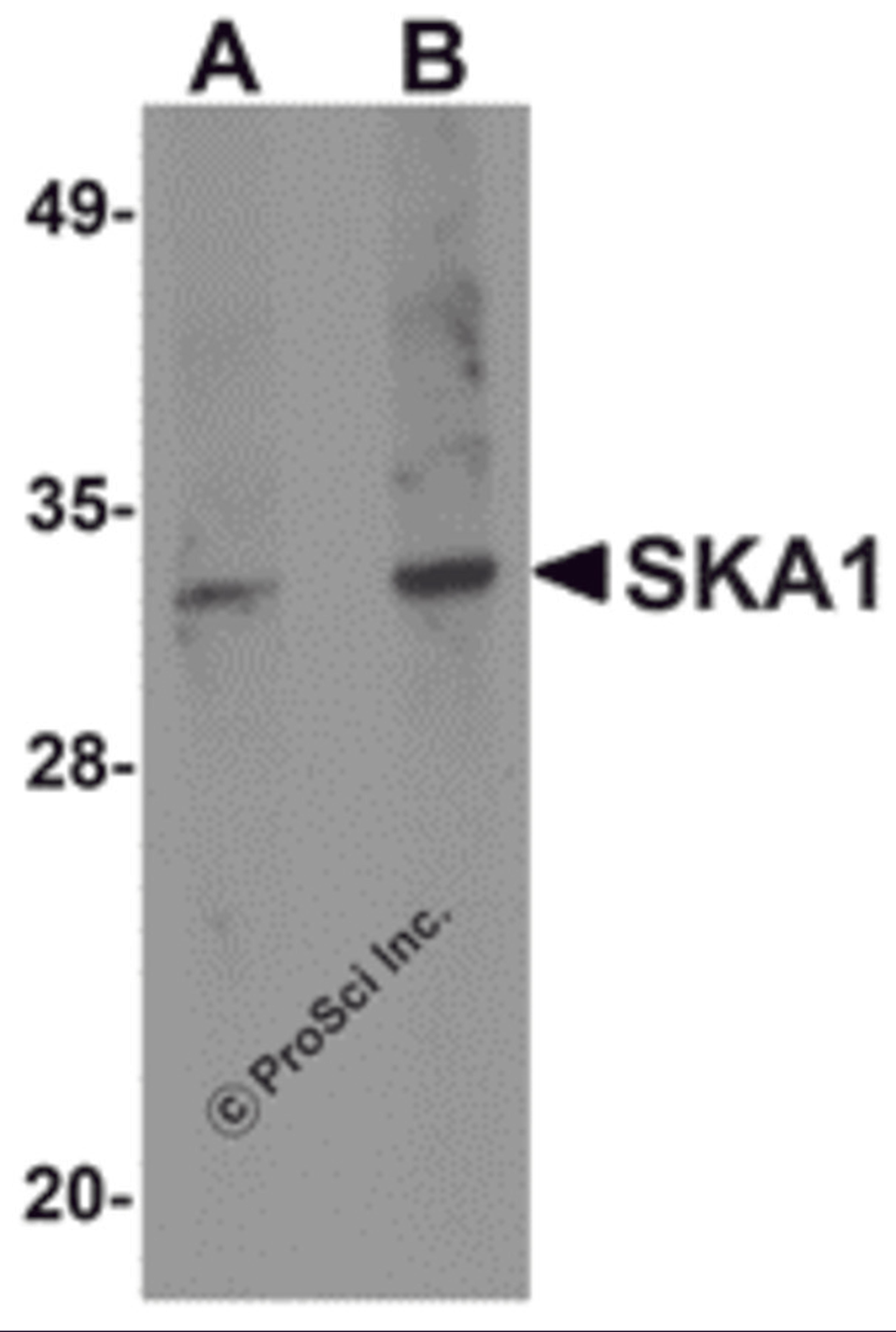 Western blot analysis of SKA1 in A549 cell lysate with SKA1 antibody at (A) 0.5 and (B) 1 μg/mL.
