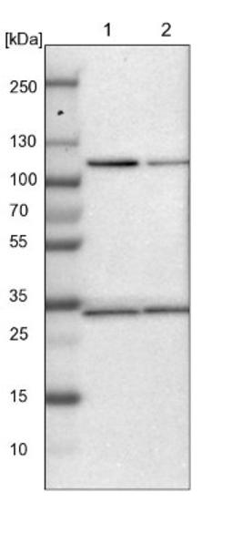 Western Blot: Jade-1/PHF17 Antibody [NBP1-83085] - Lane 1: NIH-3T3 cell lysate (Mouse embryonic fibroblast cells)<br/>Lane 2: NBT-II cell lysate (Rat Wistar bladder tumour cells)