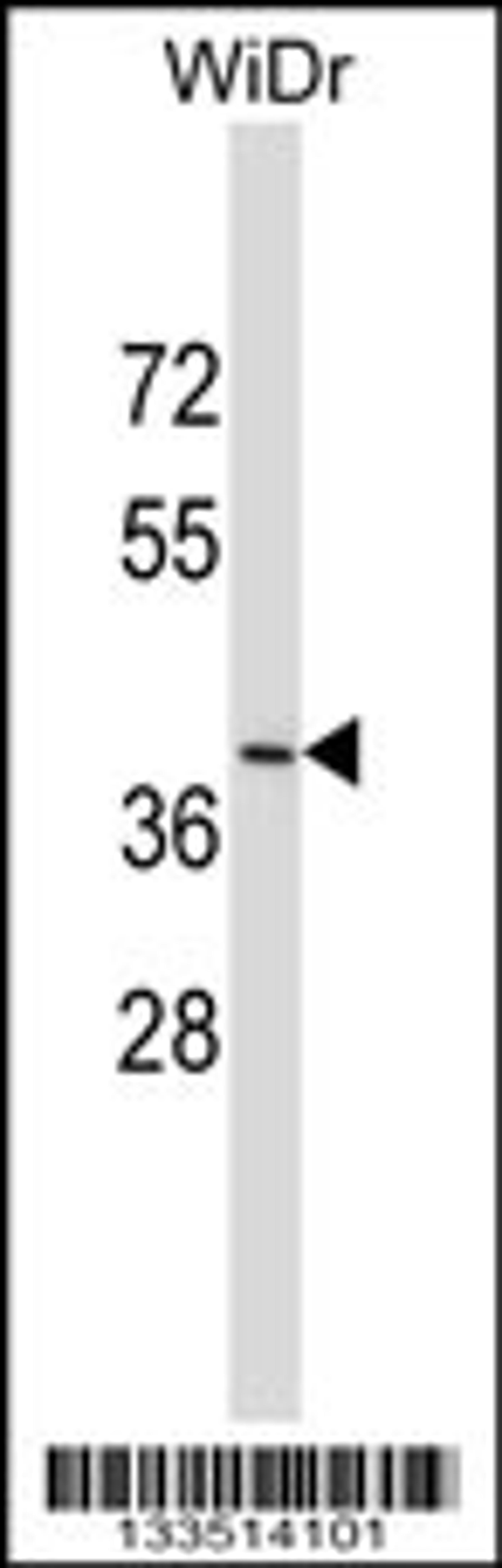 Western blot analysis in WiDr cell line lysates (35ug/lane).