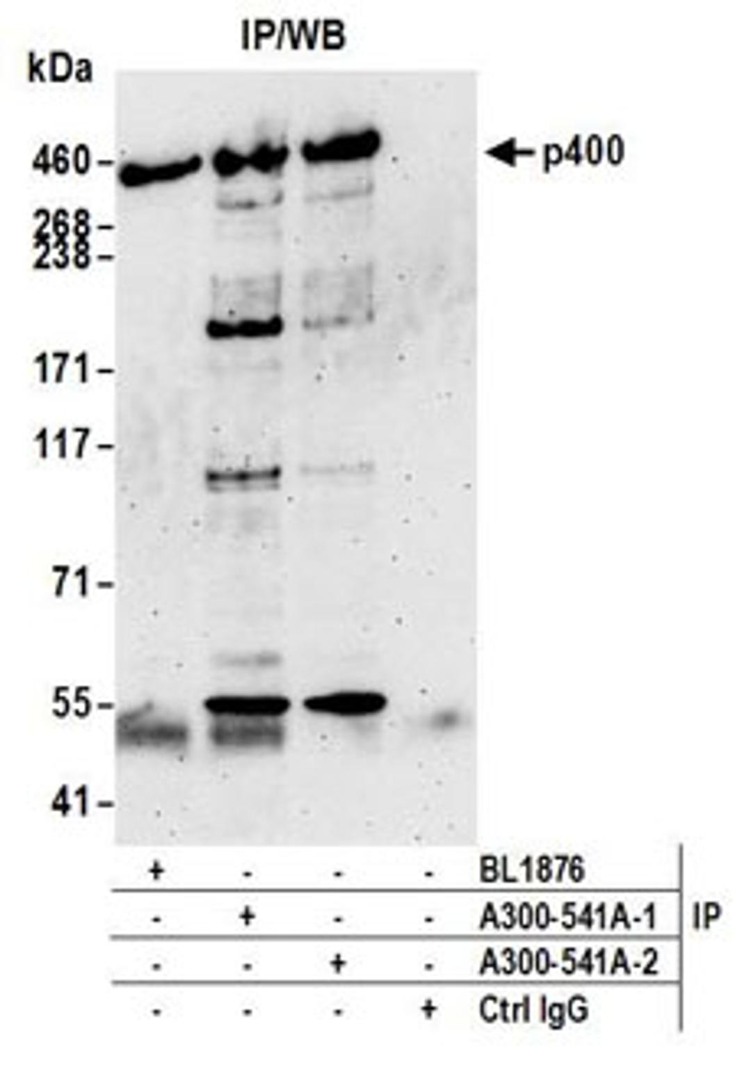 Detection of human p400 by western blot of immunoprecipitates.