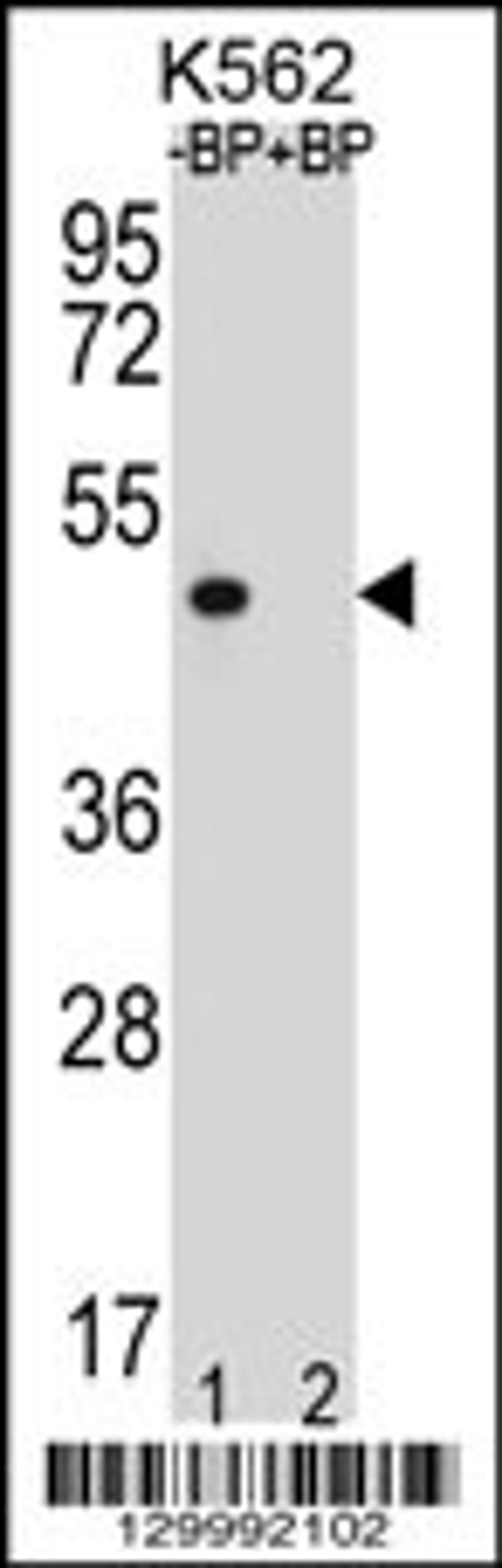 Western blot analysis of OR8K3 Antibody Pab pre-incubated without(lane 1) and with(lane 2) blocking peptide in K562 cell line lysate.