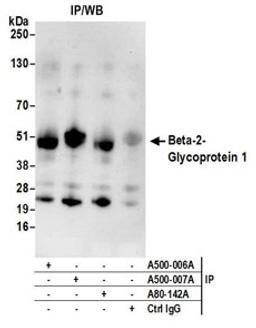 Detection of human Beta-2-Glycoprotein 1 by WB of immunoprecipitates.