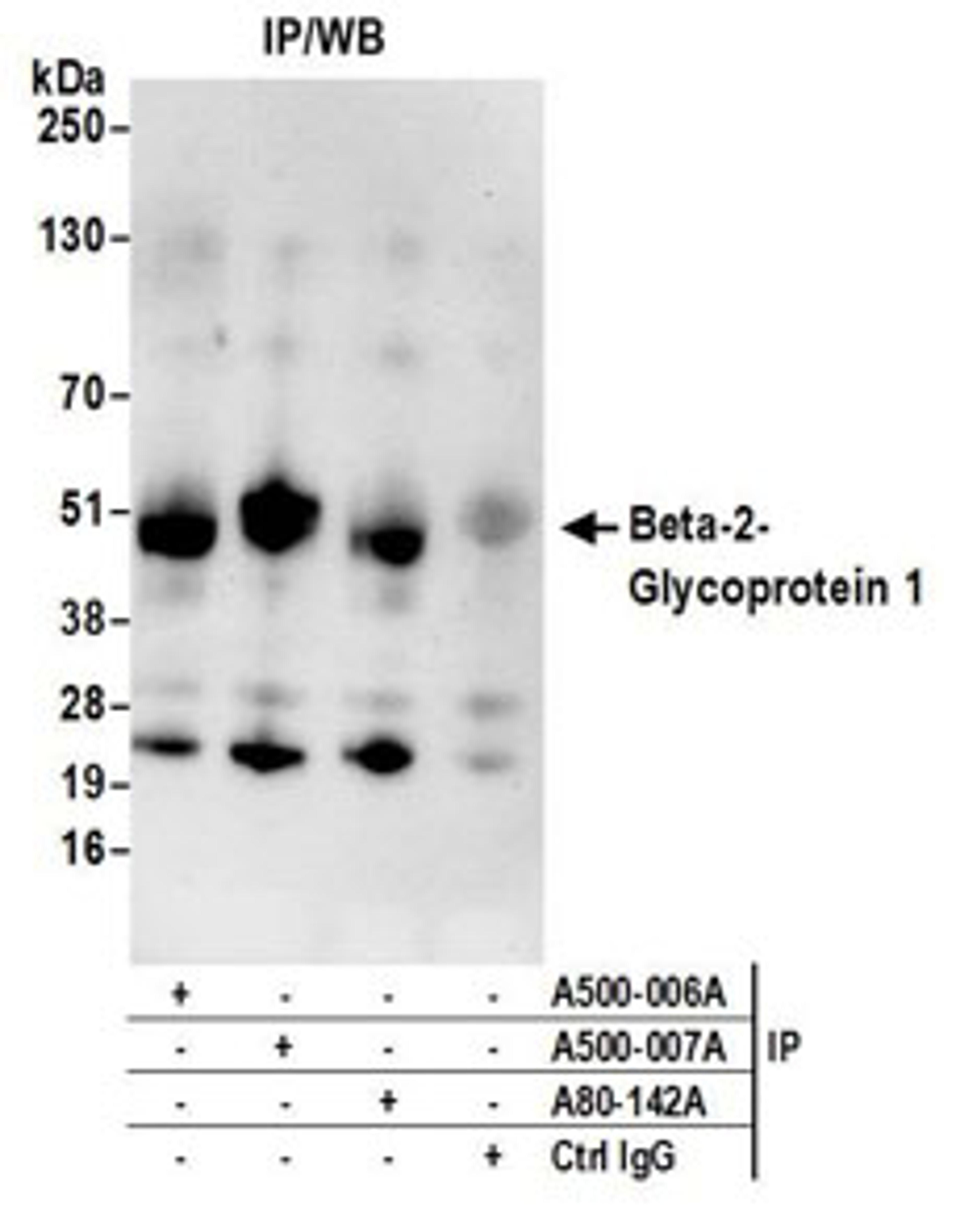 Detection of human Beta-2-Glycoprotein 1 by WB of immunoprecipitates.