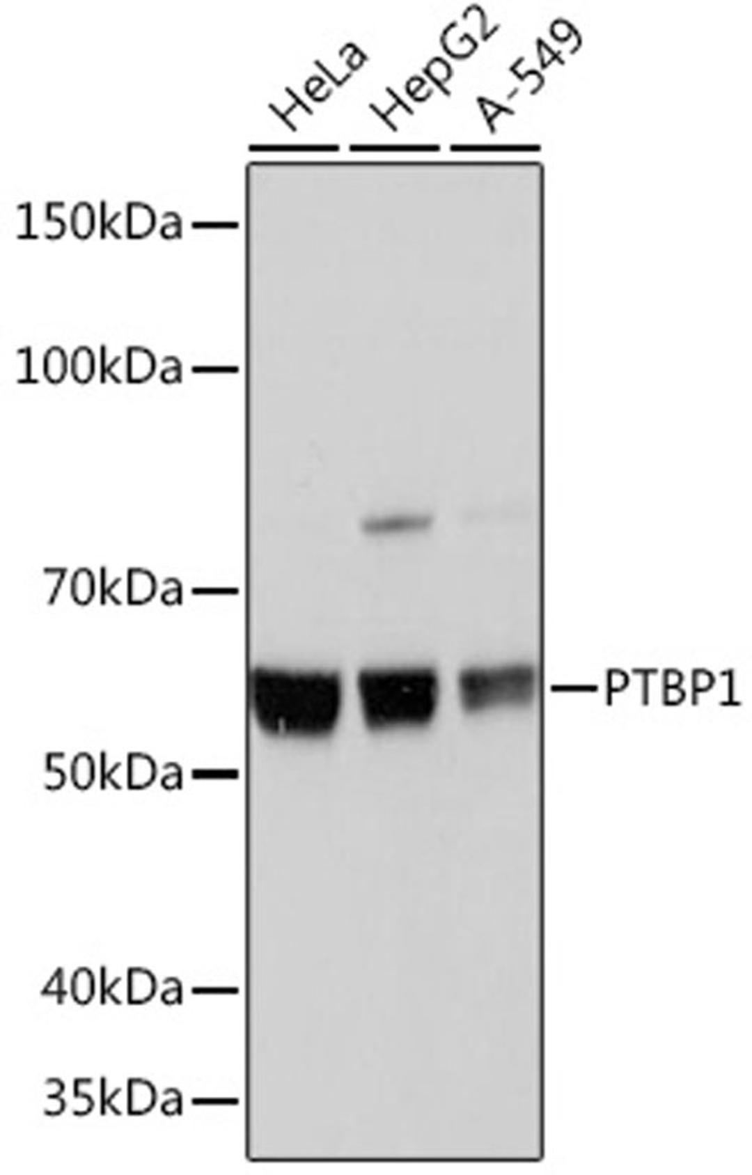 Western blot - PTBP1 Rabbit mAb (A3487)