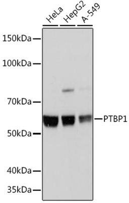 Western blot - PTBP1 Rabbit mAb (A3487)